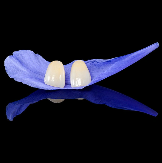 prepless veneers frisco