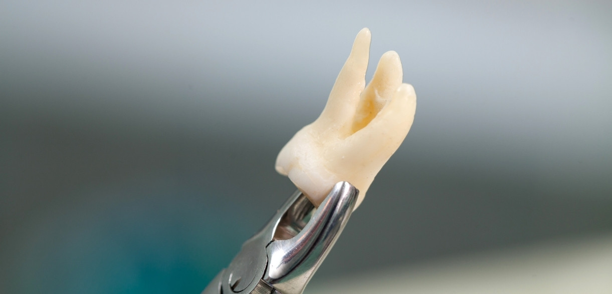 tooth extraction pain after 7 days