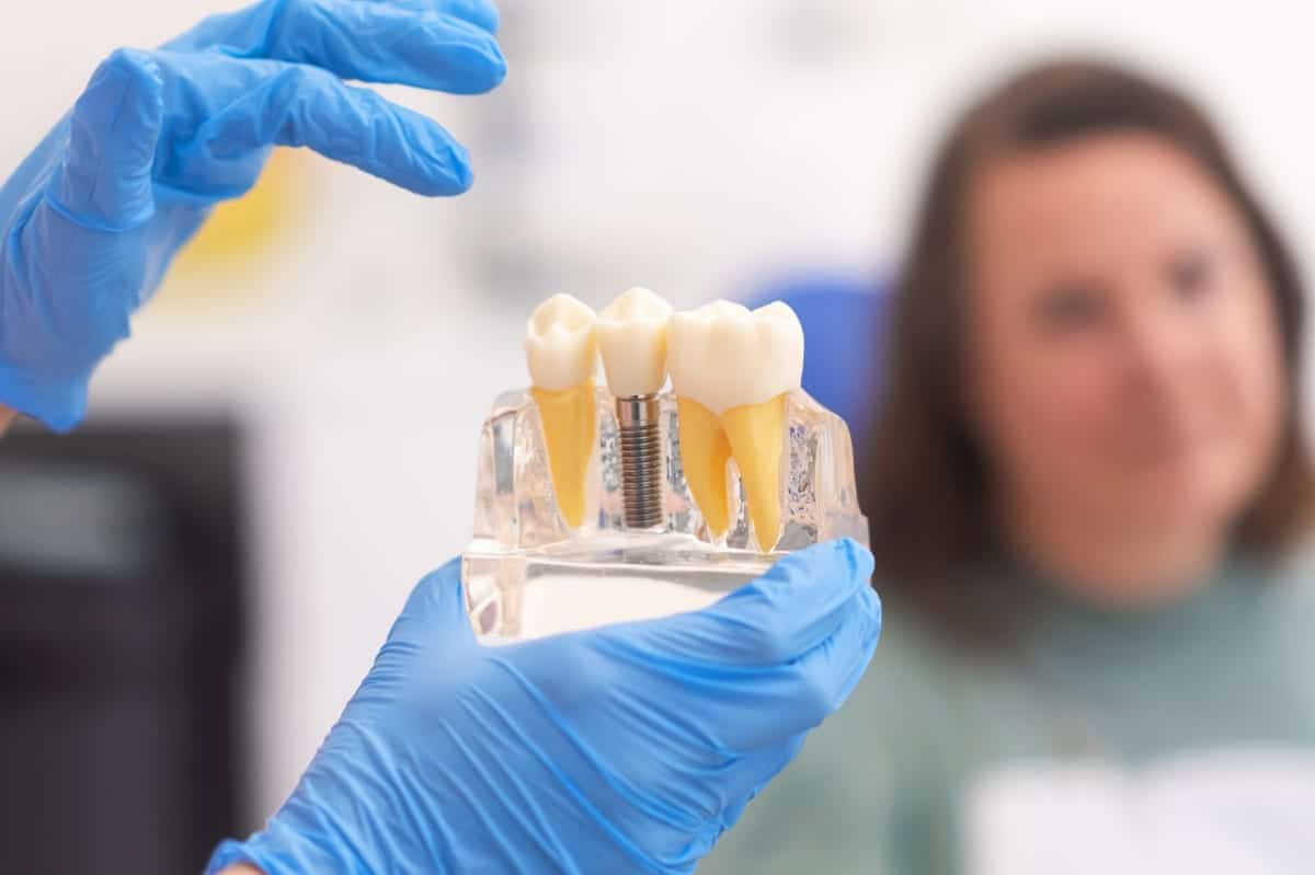 Dental Implants in Little Elm